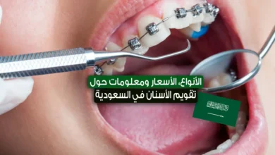 تقويم الأسنان في السعودية 2023